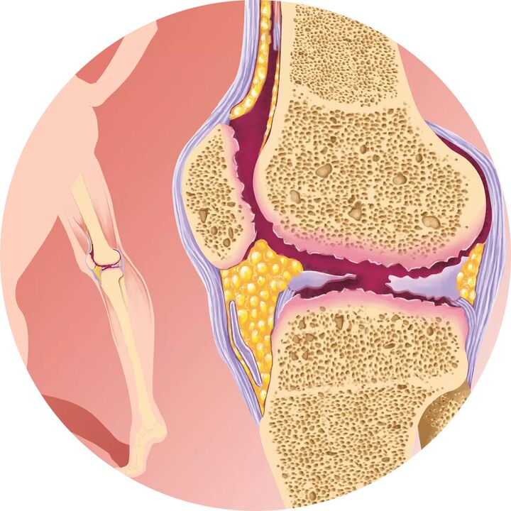 Hondrotene – Υποστηρίζει την κινητικότητα των αρθρώσεων